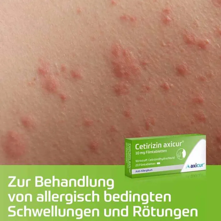 axicur Cetirizin ® 10 mg Filmtabletten, 7 St- Cetirizin|Allergie Tabletten