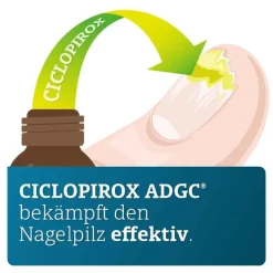 CICLOPIROX ® 80 mg/g wirkstoffhaltiger Nagellack, 3.3 ml^ADGC Sale
