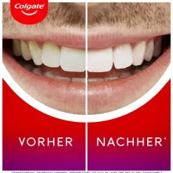 Max white Overnight whitening Serum, 2.5 ml^Colgate Hot