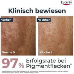 Eucerin Tagespflege|Pigmentflecken-Anti-Pigment Tagescreme LSF 30, 50 ml