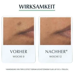 Eucerin Lsf 30|Gesicht-Dermopure schützendes Fluid LSF 30, 50 ml