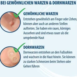 Evolsin Warzenstift-Anti-Warzen Stift, 3 ml