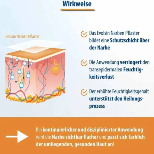 Narbenpflaster 2,5cm x 200cm, 1 St^Evolsin Sale
