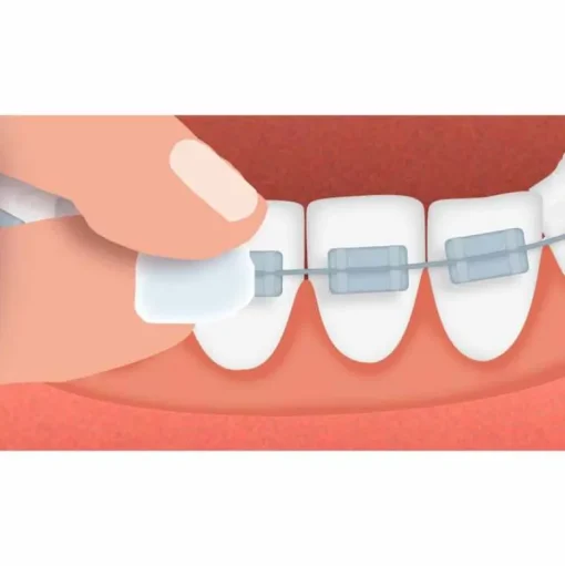 GuM Orthodontisches Wachs, 1 St- Geräte & Zubehör