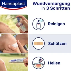 Hansaplast Elastic Fingerkuppenpflaster, 50 St- Strips|Fingerpflaster