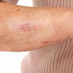 Leukomed Sterilpflaster|Spezialpflaster-® T skin sensitive 8x10 cm, 5 St