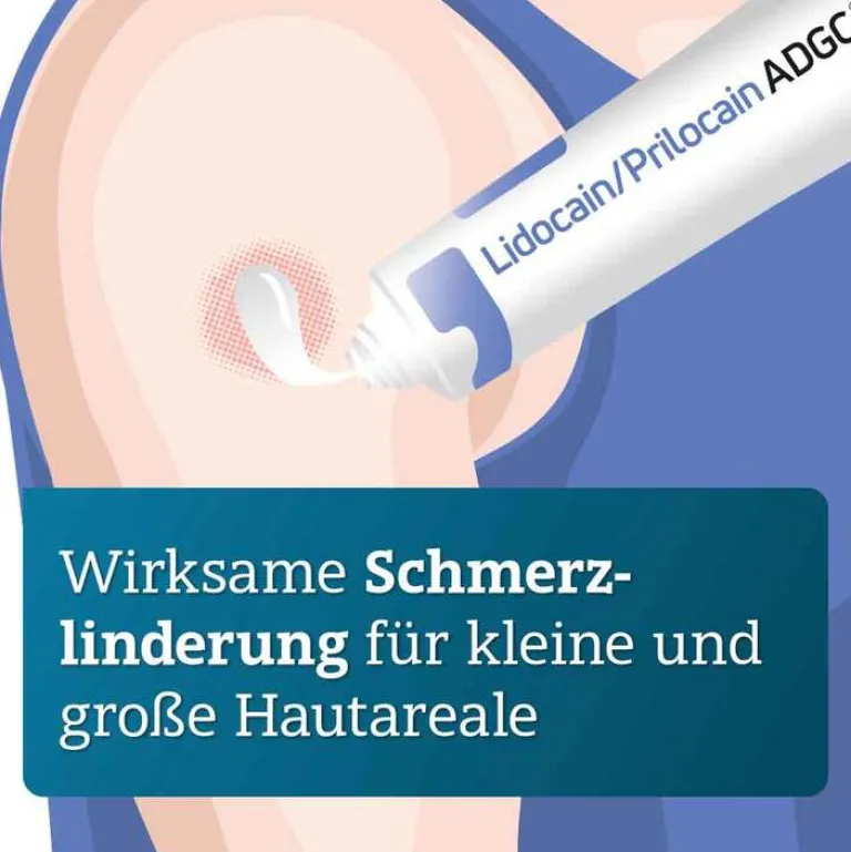 ADGC Lidocain / Prilocain 25 mg / g + 25 mg / g Creme, 30 g- Lidocain