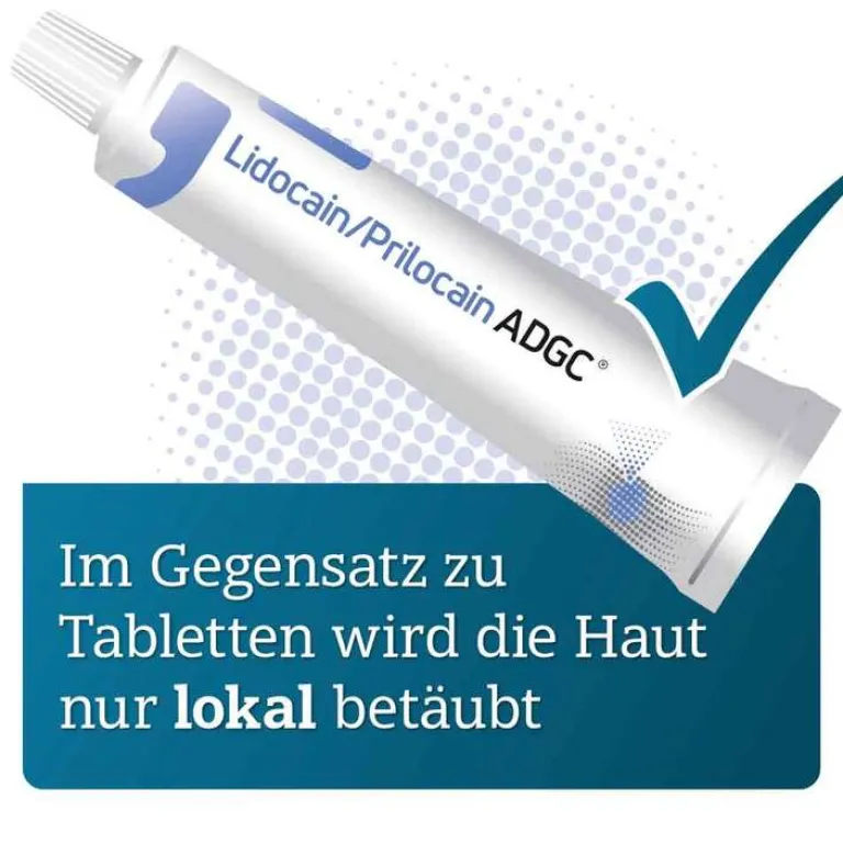 ADGC Lidocain / Prilocain 25 mg / g + 25 mg / g Creme, 30 g- Lidocain