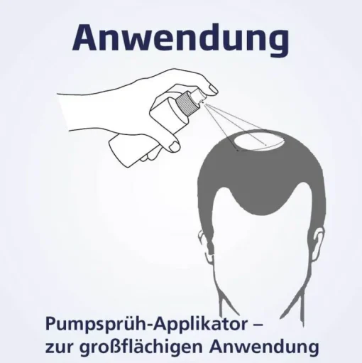 ® Männer 50 mg/ml Spray, 60 ml^Minoxicutan Outlet