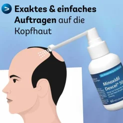 Dexcel Mittel Gegen Haarausfall-Minoxidil 50 mg / ml Spray z.Anw.a.d.Kopfhaut, 60 ml