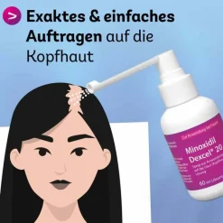 Minoxidil 20 mg / ml Spray z.Anw.a.d.Kopfhaut, 3X60 ml^Dexcel New