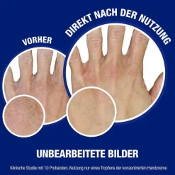 norwegische Formel Konzentrat Handcreme parfümiert, 75 ml^Neutrogena Outlet