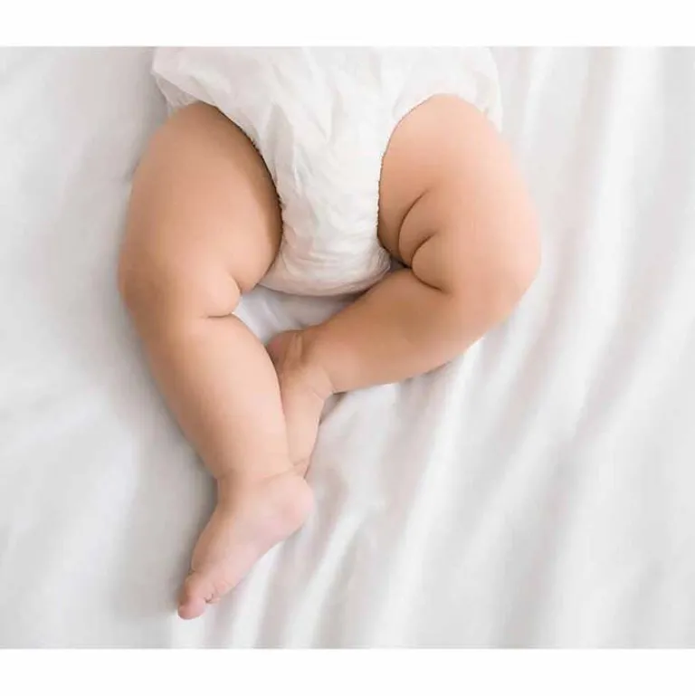 Nystaderm Paste, 20 g-Kinder Haut|Hautpilz Creme