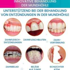 Oroxid Mundspüllösung-Sensitive Lösung, 250 ml