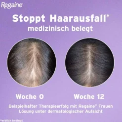 Regaine Frauen Schaum 50 mg/g, 2X60 g- Mittel Gegen Haarausfall