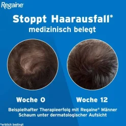 Männer Lösung, 60 ml^Regaine Online