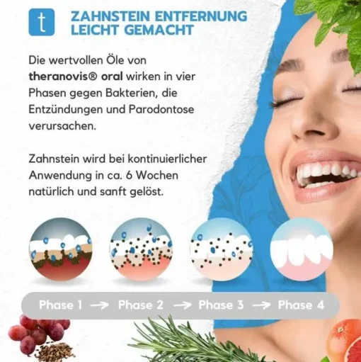 Theranovis oral Zahnstein Spray, 65 ml- Mundpflege