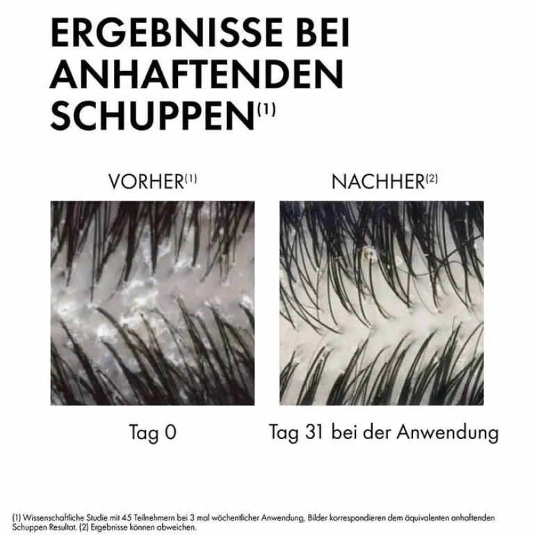 Vichy Dercos Anti-Schuppen Shampoo trockene Kopfhaut , 500 ml- Haarausfall & Schuppen