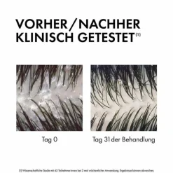 Vichy Dercos Anti-Schuppen 2in1 Shampoo und Conditioner, 200 ml- Spülungen & Lotionen|Shampoos