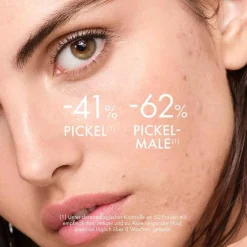 Vichy Normaderm Anti-Unreinheiten-Pflege, 50 ml- Unreine Haut|Anwendung-Produktarten