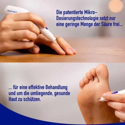 Wartner Warzenstift-Stift gegen Warzen 2.0, 1 St