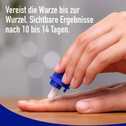 Warzen Spray, 50 ml^Wartner Clearance